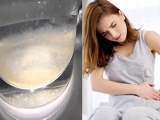 VÌ SAO NƯỚC ĐUN SÔI LẠI CÓ CẶN TRẮNG?