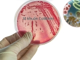 COLIFORM LÀ GÌ? MỐI NGUY HẠI TIỀM TÀNG TỪ CHỦNG VI KHUẨN NÀY